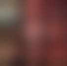 Image result for Inguinal hernia child