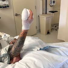 Ozzy Osbourne Has Hand Surgery and Postpones Concert