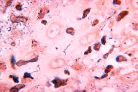 Image result for Pseudoeriosema