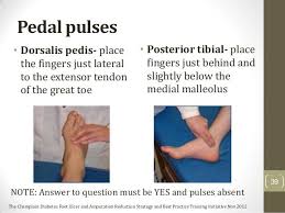 Posterior Tibial Pulse Google Search Nursing School Life Best Nursing Schools Nursing School Prerequisites