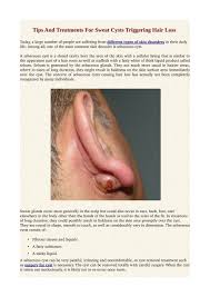 • hair loss begins about 3 months after a definable precipitating event. Tips And Treatments For Sweat Cysts Triggering Hair Loss