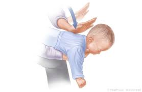 How to give a baby cpr. Choking Rescue For Babies Cs Mott Children S Hospital Michigan Medicine