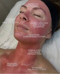 Hi does anyone know of an aesthetics training place that offers treatments  at model prices or is there a page that advertises this TIA