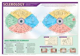 Sclerology Eye Chart Iriscope Iridology Camera