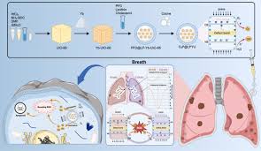 Image result for Intrapleural Anesthesia