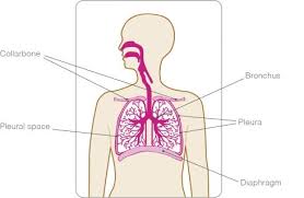 Breast pain, otherwise known as mastalgia, mastodynia, or mammalgia, can occur for a number of re. Secondary Breast Cancer In The Lung