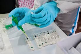 Antigenní rychlotest dokáže tyto bílkoviny ve vzorku detekovat. Lide V Decine Maji Opet Moznost Nechat Si Udelat Antigenni Test Bez Objednani Sever