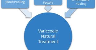 Pin On Varicocele
