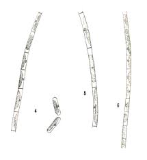 Image result for Gilgiochloa