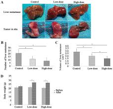 Pancreatic metastasis is a serious diagnosis. Emodin Inhibits Pancreatic Cancer Emt And Invasion By Up Regulating Microrna 1271
