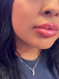 if you've been thinking about facial balancing, here's your sign! ✨ . . .  📍: 76108 📲 : 682.804.3645 🎀 : books open 💻 : kkouturexo 🌎 :  www.kkouturexo.com 💌 : beauty@kkouturexo.com