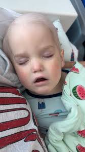 Working out during chemotherapy treatment