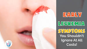 However, recognizing the early signs can significantly improve a person's outlook. 14 Early Leukemia Symptoms You Shouldn T Ignore At All Costs Youtube