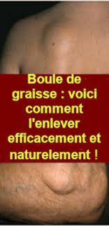 Passez une éponge tiède ou un sopalin pour enlever la pâte et la graisse avec. Boule De Graisse Voici Comment L Enlever Efficacement Et Naturellement Sante Tips