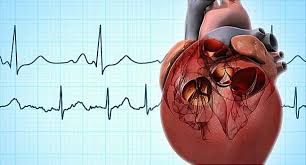 Image result for Atrial Fibrillation