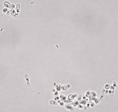 Urine Sediment From A Cat On Antibiotics Vet Medicine Antibiotic Cat Care Tips