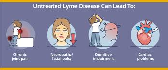 Image result for Lyme Carditis