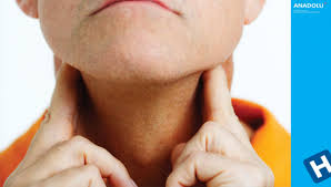 Symptoms include enlarged lymph nodes, fever, night sweats, weight loss and tiredness. Limfonul Hodgkin Non Hodgkin Centrul Medical Anadolu