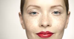 Beauty Trend: Freckles are taking Vancouver by storm!