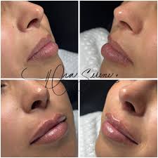 MAX LOZANO EN LA FINAL NACIONAL @_maxlok