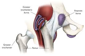The pubis, ischium, and ilium together constitute the pelvis while the thigh bone is the femur. Hip Bursitis Orthoinfo Aaos