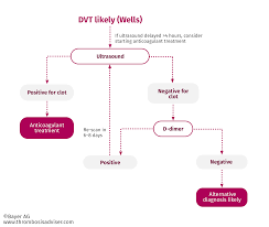 deep vein thrombosis diagnosis risk assessment