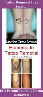 It may be a hard pill to swallow but keep in mind that this includes every tattoo removal treatment session. Cosmetic Tattoo Removal Tattoo Removal Hertfordshire Aloe Vera Tattoo Removal New Tattoo Removal How Much Is Tattooentfernung Selbstgemachte Tattoos Diy Tattoo