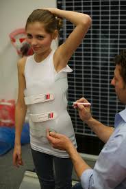 فقدان التصحيح بعد ازاله حزام اعوجاج العمود الفقري