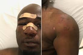 Another Rikers officer beat up by inmate during ambush