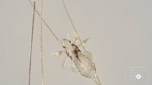 How much will hair lice removal treatments cost? How Lice Turn Your Hair Into Their Jungle Gym Kqed
