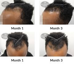 These girls hair style ideas are so easy to do! Hair Growth Success Story The Discipline Paid Off