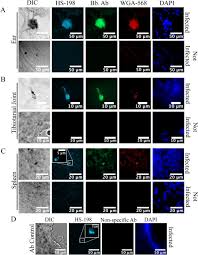 Of the 77 devices cleared by the fda for in vitro borrelia. Visualizing Borrelia Burgdorferi Infection Using A Small Molecule Imaging Probe Biorxiv