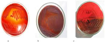 This study was conducted to compare these three methods for. Extracelluler Enzymes Pathogenicity And Biofilm Forming In Staphylococci