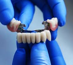 Our diagnostic and treatment philosophy is to take a proactively conservative approach towards dental issues. Dental Bridges Franklin Tn Replace Missing Teeth With A Fixed Bridge