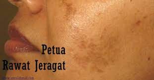 Thanks to tinta pena for the camera. 3 Petua Mudah Untuk Hilangkan Jeragat Muka Bagi Lebih Berseri Azeniahmad Com