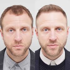 Farjo Hair Institute