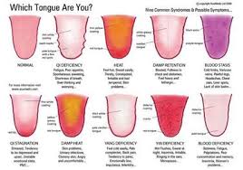 Tongue Diagnosis Wikipedia