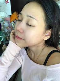 Lidah buaya untuk hilangkan jerawat blackhead dan whitehead. Kulit Gadis Ini Putih Licin Tanpa Blackhead Caranya Cuma Guna Baking Soda Vanilla Kismis