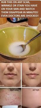 J Anne Toms (jannetoms)