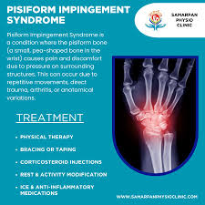 Image result for Pisiform Bone