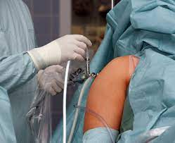 Schulteroperation Informationen Uber Schulter Ops