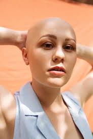 Cette série photo célèbre la beauté des femmes chauves