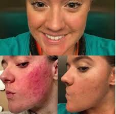 All things skin and health by Karen