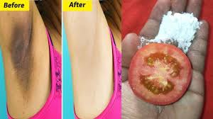 Orange peels work naturally on your skin and helps to prevent the darkness by removing dead skin cells. Just 5 Minutes Whitening Dark Underarm Challenge How To Get Rid Of Dark Underarms Overnight Youtube