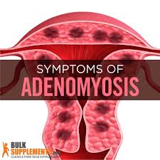 Adenomyosis is when these cells exist or grow into the uterine wall. Adenomyosis Vs Endometriosis Archives Bulksupplements Com