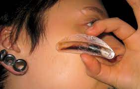 Alltagsblog Und Erfahrungsberichte Septumplastik Nasenscheidewand Op Nasenmuschelreduktion