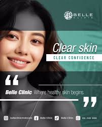 Confidence starts with clear, healthy skin., At Belle Clinic, we help you  achieve that glow — safely and effectively., 💚 Book your consultation  today!