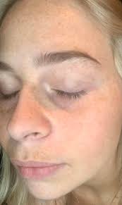 Healthy Glow Esthetics by Heather