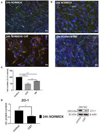 179 markus prinz premium high res photos. Frontiers Increased Catecholamine Levels And Inflammatory Mediators Alter Barrier Properties Of Brain Microvascular Endothelial Cells In Vitro Cardiovascular Medicine