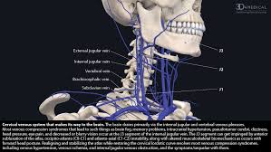 The carotid system of arteries and the jugular system of veins. Cervical Spine Compression Causes Internal Jugular Vein Stenosis Caring Medical Florida